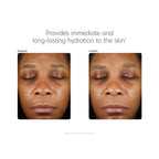 PCA SKIN Hyaluronic Acid Boosting Serum