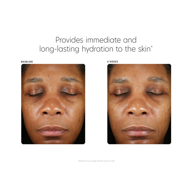 PCA SKIN Hyaluronic Acid Boosting Serum