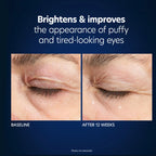 PCA SKIN Hyaluronic Acid Microneedle Eye Patches - Box of 4 Pairs