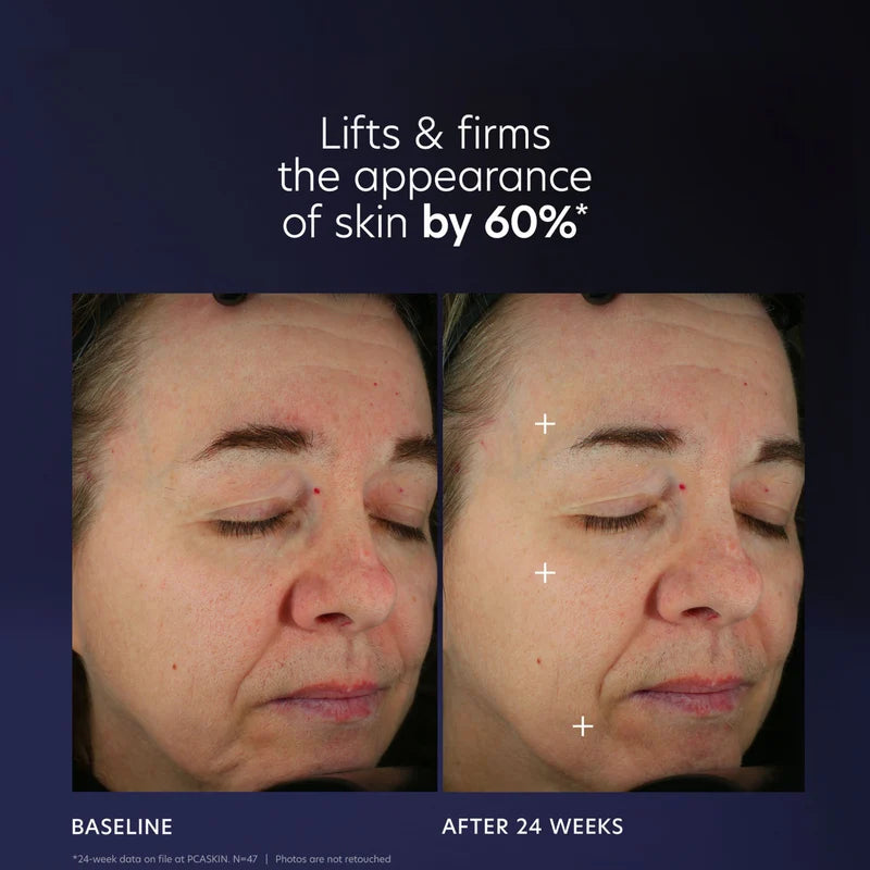 PCA SKIN Pro-Max Age Renewal Serum