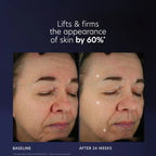 PCA SKIN Pro-Max Age Renewal Serum