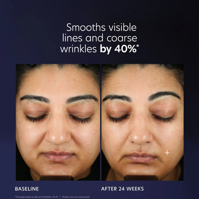 PCA SKIN Pro-Max Age Renewal Serum
