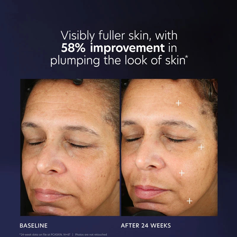 PCA SKIN Pro-Max Age Renewal Serum