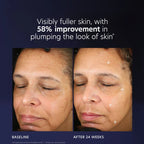 PCA SKIN Pro-Max Age Renewal Serum